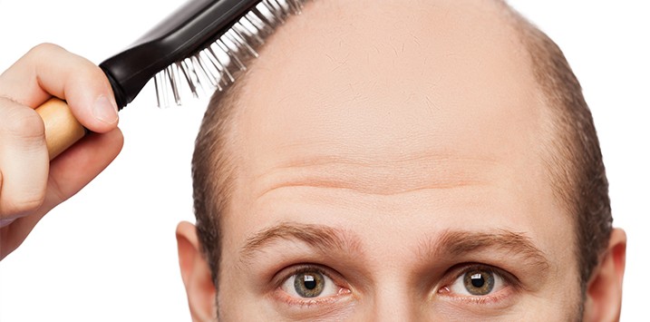 Hair Transplant and Restoration