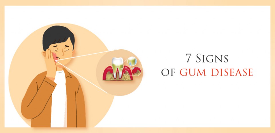 7 Signs of Gum Disease