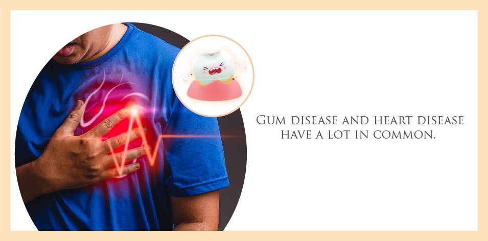 Gum disease and heart disease have a lot in common
